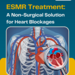Understanding ESMR Treatment: A Non-Surgical Solution for Heart Blockages